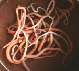 Paraisítí intestinal