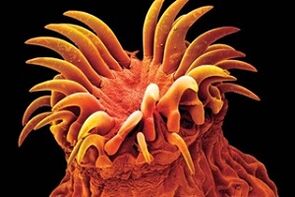 Paraisítí trematode i ndaoine